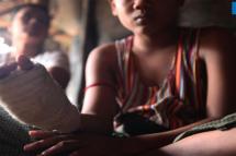 လက်ချောင်း သုံးချောင်း ဆုံးရှုံးသွားသော်လည်း မိသားစုအသုံးစရိတ်ထောက်ပံ့ရန် အလုပ် ဆက်လုပ်လိုသေးသည့် အသက် ၁၂ နှစ်အရွယ် မောင်ချစ်မင်းထွေး (ဓာတ်ပုံ - ကေဇွန်နွေး/Myanmar Now) 