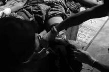 ပုံအညွှန်း- စစ်ကောင်စီတပ်​၏ လက်နက်ကြီးကြောင့် ဒဏ်ရာရ ပြည်သူတစ်ဦး ( ဓါတ်ပုံ- KNU)
